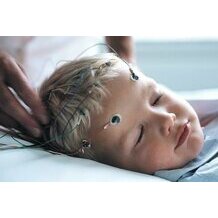 Utilisation des lectrodes ECG cupules Ambu Neuroline 726